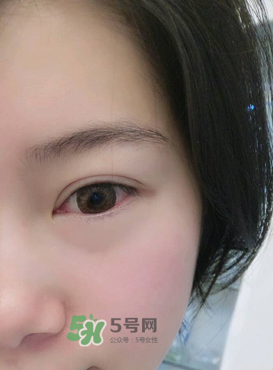 做美瞳線疼嗎？做美瞳線后要注意什么？