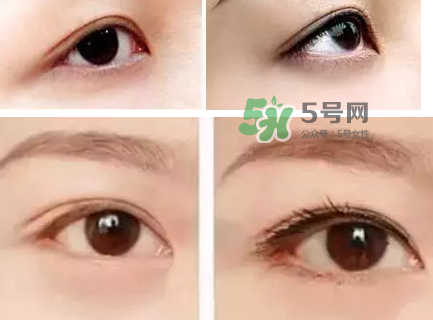 做美瞳線可以吃雞蛋嗎？做美瞳線能吃雞蛋嗎？