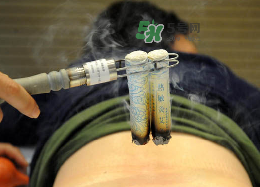 三伏天艾灸后能吹空調(diào)嗎？三伏天艾灸后能吹電扇嗎？