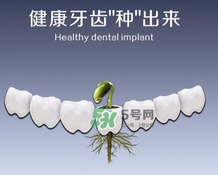 種植牙費用多少錢？國產(chǎn)種植牙價格