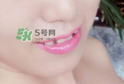 牙齒縫隙大怎么辦？牙縫大帶牙套有用嗎