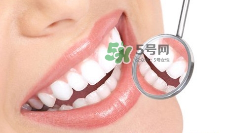 牙齒縫隙大怎么辦？牙縫大帶牙套有用嗎