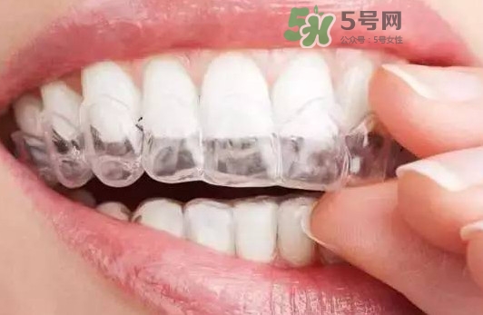 牙齒有縫隙可以補(bǔ)嗎？牙齒縫隙大能補(bǔ)嗎