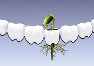 種植牙多少錢一顆？為什么種植牙很貴