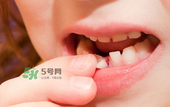 牙齒松動(dòng)可以重新長(zhǎng)牢固嗎？牙齒松動(dòng)可以修復(fù)嗎