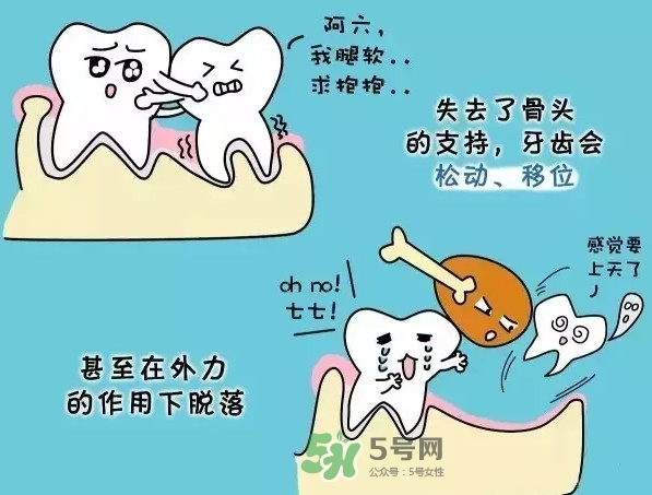 牙齒松動(dòng)會(huì)自己好嗎？牙齒松動(dòng)會(huì)自己掉嗎