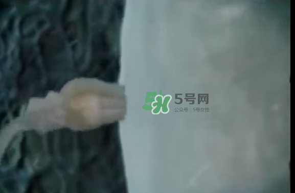 懷孕初期怎么保胎？陰道出血是流產(chǎn)征兆嗎？
