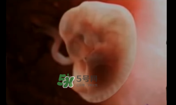 懷孕初期怎么保胎？陰道出血是流產(chǎn)征兆嗎？