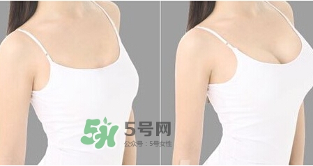 女性乳頭癢是怎么回事？女性乳頭癢要怎么治療？