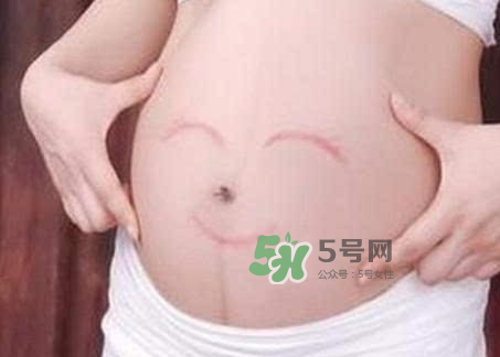 產(chǎn)婦胃脹氣怎么緩解？產(chǎn)婦胃脹氣怎么辦？