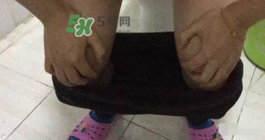 孕期可以蹲著上廁所嗎？孕期上廁所會壓到寶寶嗎？