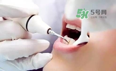 孕婦能矯正牙齒嗎？懷孕期間可以矯正牙齒嗎？