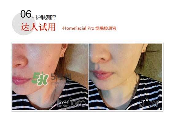homefacialpro煙酰胺原液怎么樣？hfp煙酰胺原液好用嗎