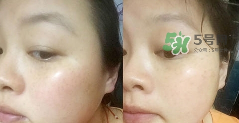 可思美潔面儀好不好用？可思美凈致潔顏聲波潔面儀怎么樣？
