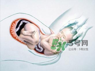 順產(chǎn)和剖腹產(chǎn)哪個(gè)好？順產(chǎn)和剖腹產(chǎn)哪個(gè)痛？