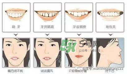 乳牙齲齒要不要補(bǔ)？乳牙齲齒怎么辦？