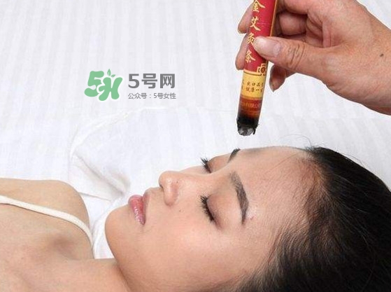 艾灸會(huì)不會(huì)過(guò)敏？艾灸過(guò)敏怎么辦