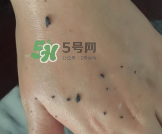 韓后茶蕊去角質(zhì)素怎么用？韓后茶蕊亮滑去角質(zhì)素用法