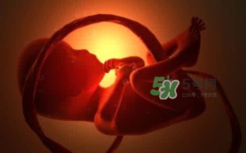寶寶臍帶繞頸只能剖腹產(chǎn)嗎？胎兒臍帶繞頸孕婦有什么感覺(jué)