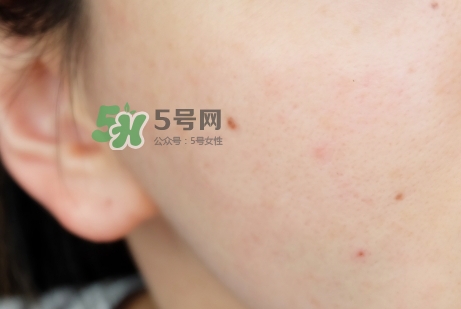 臘梅是什么牌子？臘梅是什么護(hù)膚品
