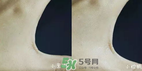 小黑瓶和小棕瓶可以一起用嗎？小棕瓶和小黑瓶哪個先用
