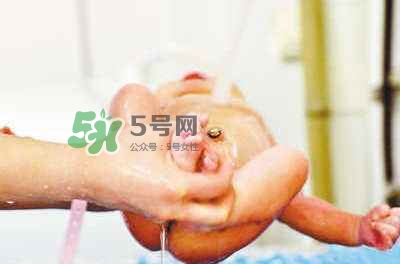 羊水栓塞是醫(yī)療事故嗎？羊水栓塞多發(fā)生于順產(chǎn)還是剖腹產(chǎn)？