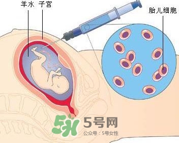 羊水栓塞是怎么回事？羊水栓塞怎么預(yù)防？