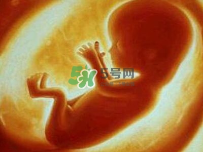 臍帶繞頸是什么原因造成的？臍帶繞頸是多休息還是多運動？