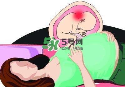 孕婦左側(cè)臥睡不著怎么辦？孕期左側(cè)睡不舒服怎么辦？