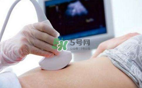 臍帶繞頸是什么原因造成的？臍帶繞頸是多休息還是多運動？