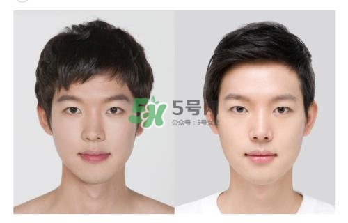 美白針有副作用嗎？美白針有什么副作用？