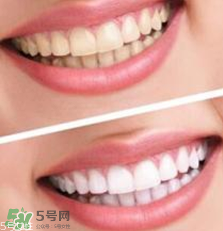碧緹福美牙儀對(duì)牙齒有傷害嗎？碧緹福美牙儀會(huì)反彈嗎？