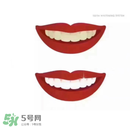 美牙儀能帶上飛機(jī)嗎？美牙儀可以過安檢嗎？