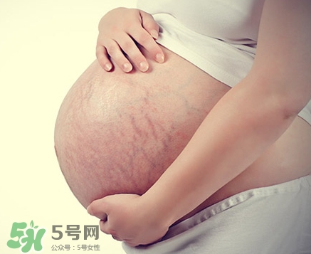 孕婦胸部長妊娠紋嗎？胸部長妊娠紋了怎么辦？