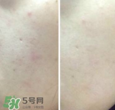 美康粉黛氣墊bb怎么樣？美康粉黛氣墊bb毀容