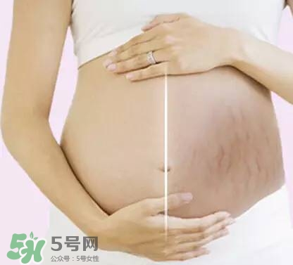 長妊娠紋的前兆 長妊娠紋很癢怎么辦？