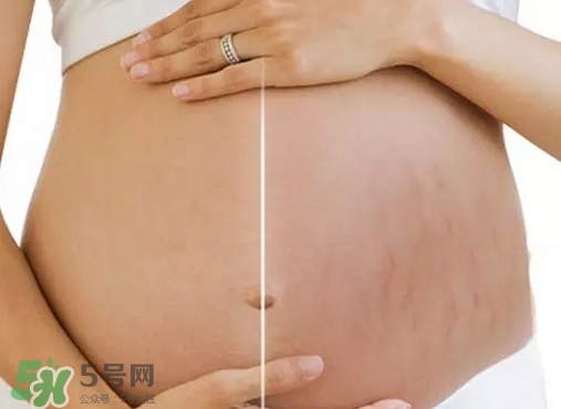 脖子上會長妊娠紋嗎？妊娠紋長在哪些地方？