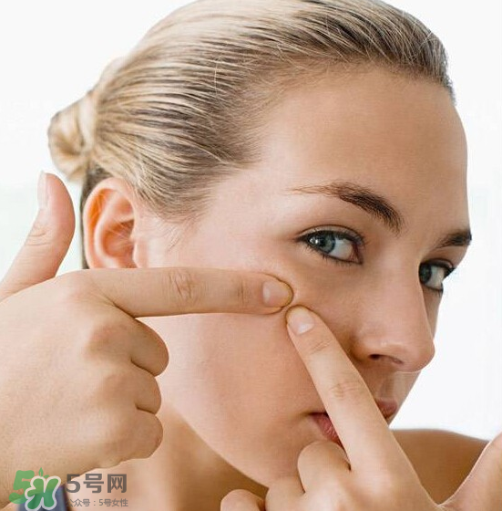 長痘長閉口怎么辦？長痘長閉口是什么原因？