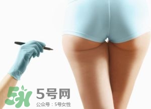 吸脂減肥副作用有哪些？吸脂減肥可靠嗎？