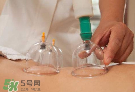 真空拔罐有用嗎？真空拔罐多長時(shí)間合適