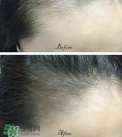發(fā)際線粉要卸妝嗎_怎么卸？