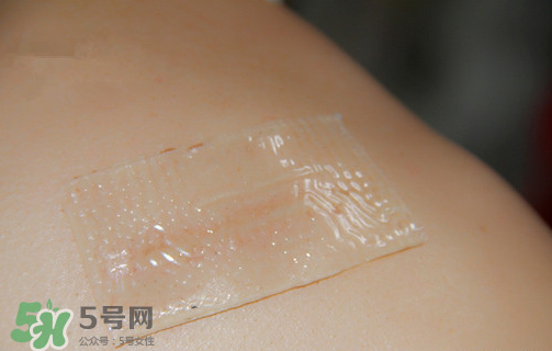 仙卡疤痕貼有用嗎？仙卡疤痕貼效果怎么樣？
