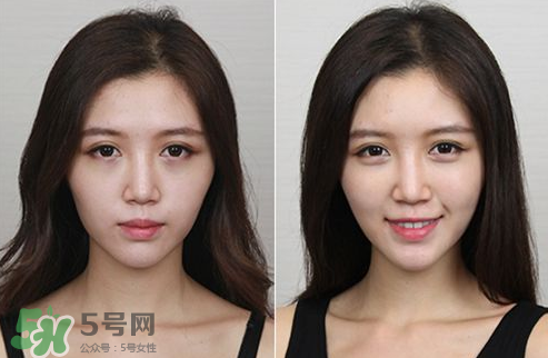 蘋果肌怎么化？蘋果肌究竟哪里好？