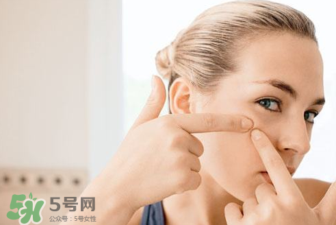 暗瘡可以擠壓嗎？油性和骯臟肌膚會容易有暗瘡嗎？