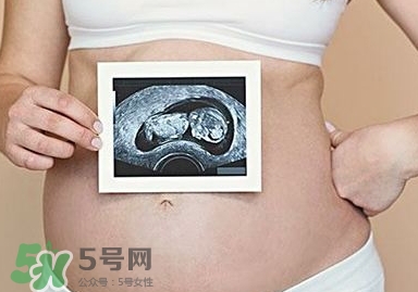 雙子宮可以上環(huán)嗎？雙子宮上環(huán)要注意哪些？
