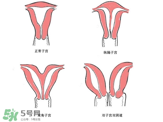 雙子宮是什么意思？雙子宮可以順產(chǎn)嗎？