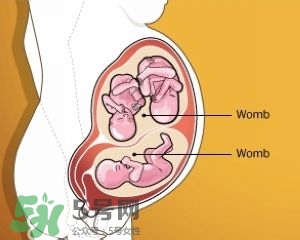 雙子宮是什么意思？雙子宮可以順產(chǎn)嗎？