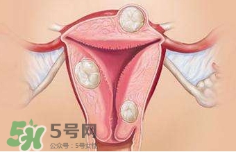 雙子宮可以上環(huán)嗎？雙子宮上環(huán)要注意哪些？