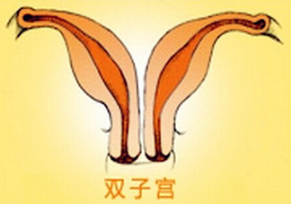 雙子宮是什么意思？雙子宮可以順產嗎？