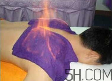 火療真的能治病嗎？火龍液的功效與作用